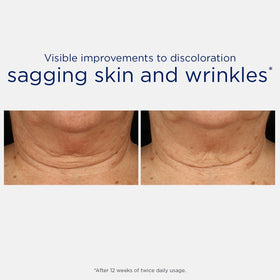 NEOSTRATA applied to neck showing smoothing effect in use