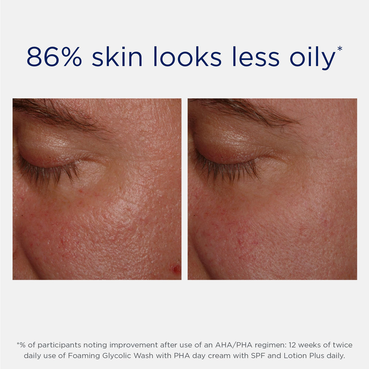 NEOSTRATA application on face demonstration indicating even coverage and prep benefit