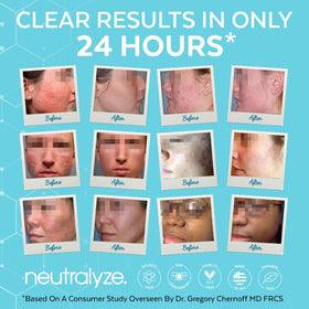 Neutralyze 5 fl oz bottle in hand showing travel-friendly size benefit