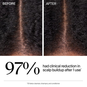 Neutrogena before and after scalp image indicating reduced buildup and cleaner roots benefit