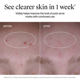 Neutrogena ingredient highlight showing salicylic acid detail, pore-clearing benefit