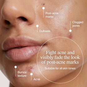 Neutrogena label close-up highlighting acids and concentration for clarity