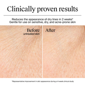 Neutrogena product label close-up showing hyaluronic acid and gentle formula