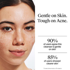 Neutrogena lather on hand demonstrating effective oil removal benefit