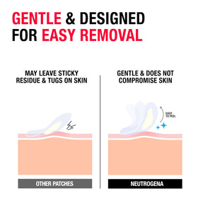 Neutrogena patch applied to cheek protecting pore and reducing picking