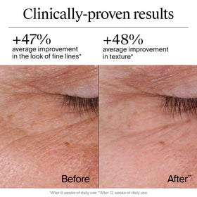 Neutrogena retinol cream label close-up highlighting anti-aging formula