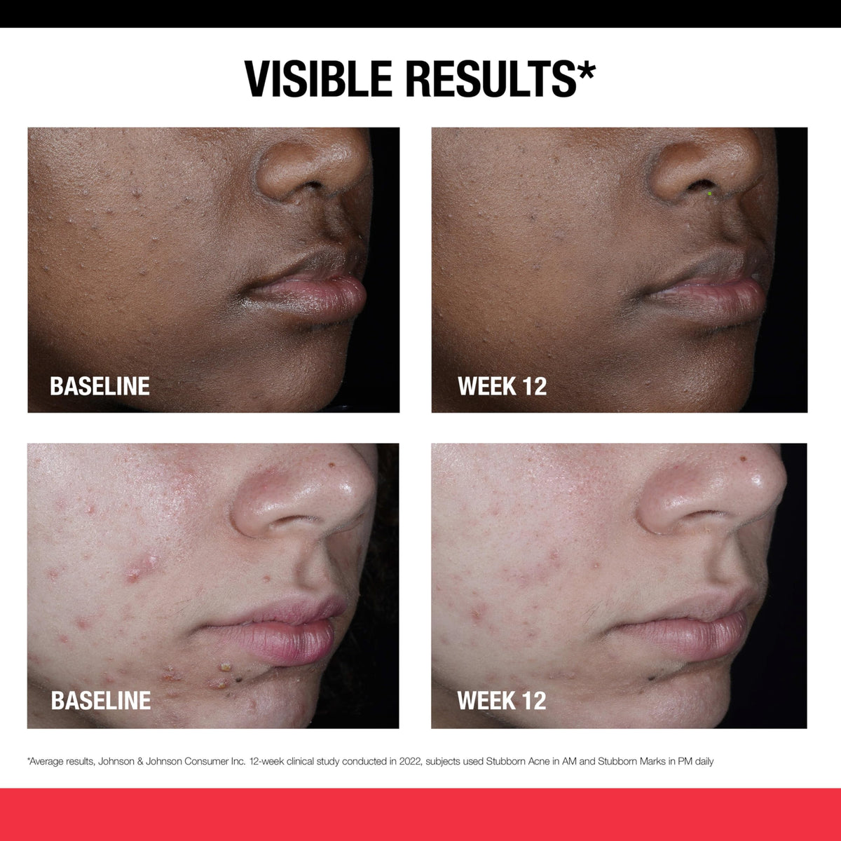 Neutrogena label detail highlighting Retinol SA ingredient