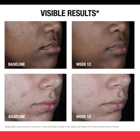 Neutrogena label detail highlighting Retinol SA ingredient