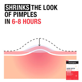 Neutrogena comparison of the two patch sizes to match different pimple types