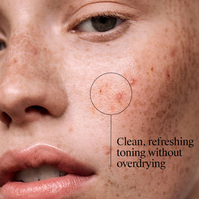 Neutrogena toner soaked on cotton pad ready for application benefit
