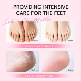New Cover used on hand and elbow to show multi-area hydration