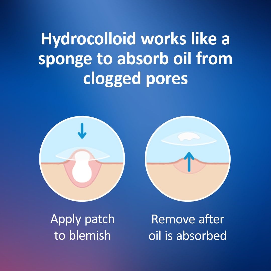 Nexcare small and medium patch sizes displayed for spot coverage benefit