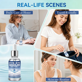 Nexkayee applied to eyelid margin demonstrating gentle targeted use