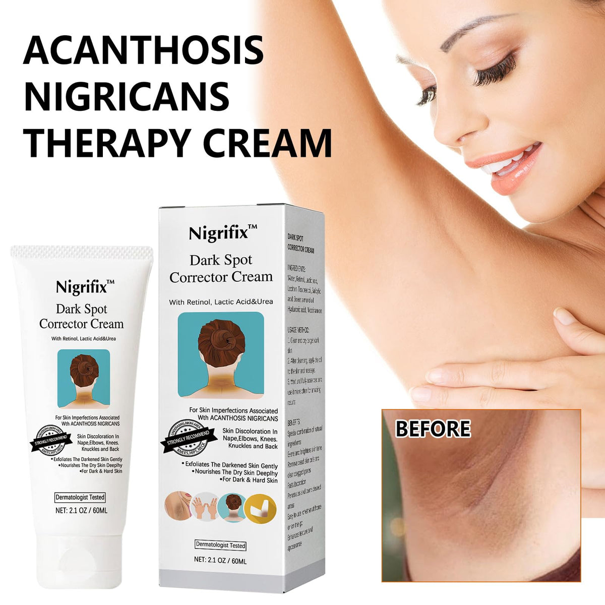 Nigrifix being applied to underarm demonstrating targeted use and gentle feel