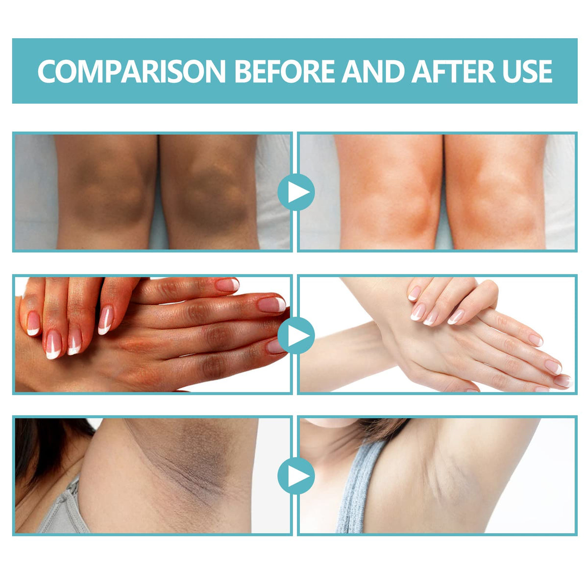 Nigrifix ingredient label closeup showing retinol and lactic acid for informed choice