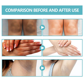 Nigrifix ingredient label closeup showing retinol and lactic acid for informed choice