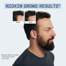 NIOXIN kit contents laid out to display shampoo and leave-in bottle sizes and labels