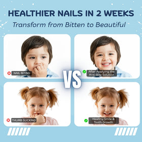 Nipit Honest10 family using product to support healthier nail habits