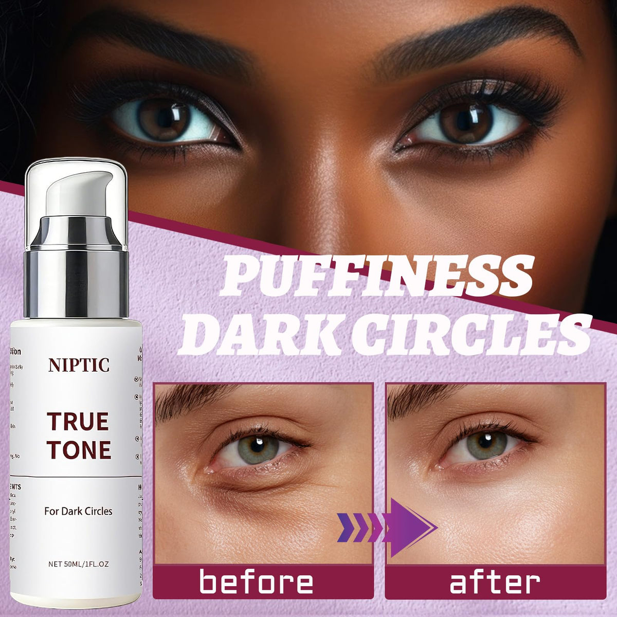 niptic before and after comparison illustrating improved under-eye tone