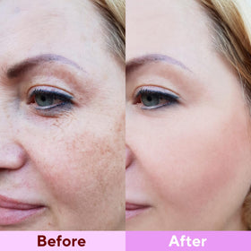 Nityrliv serum droplet on sheet detail highlighting concentrated hydration