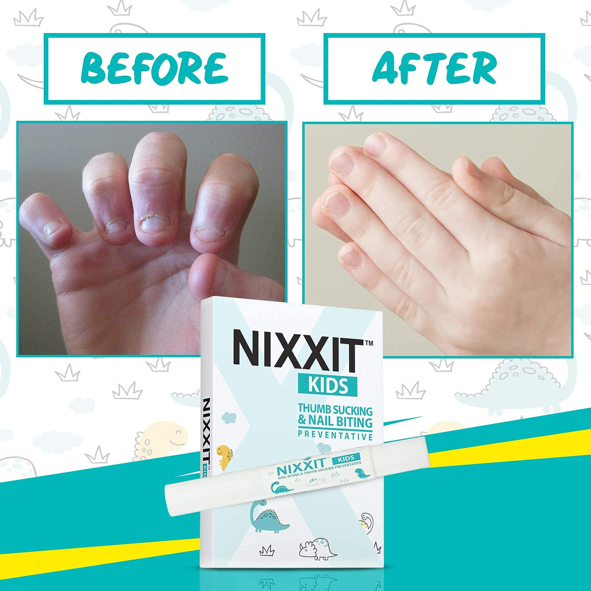 NIXXIT being applied to a child nail to discourage biting and support habit change