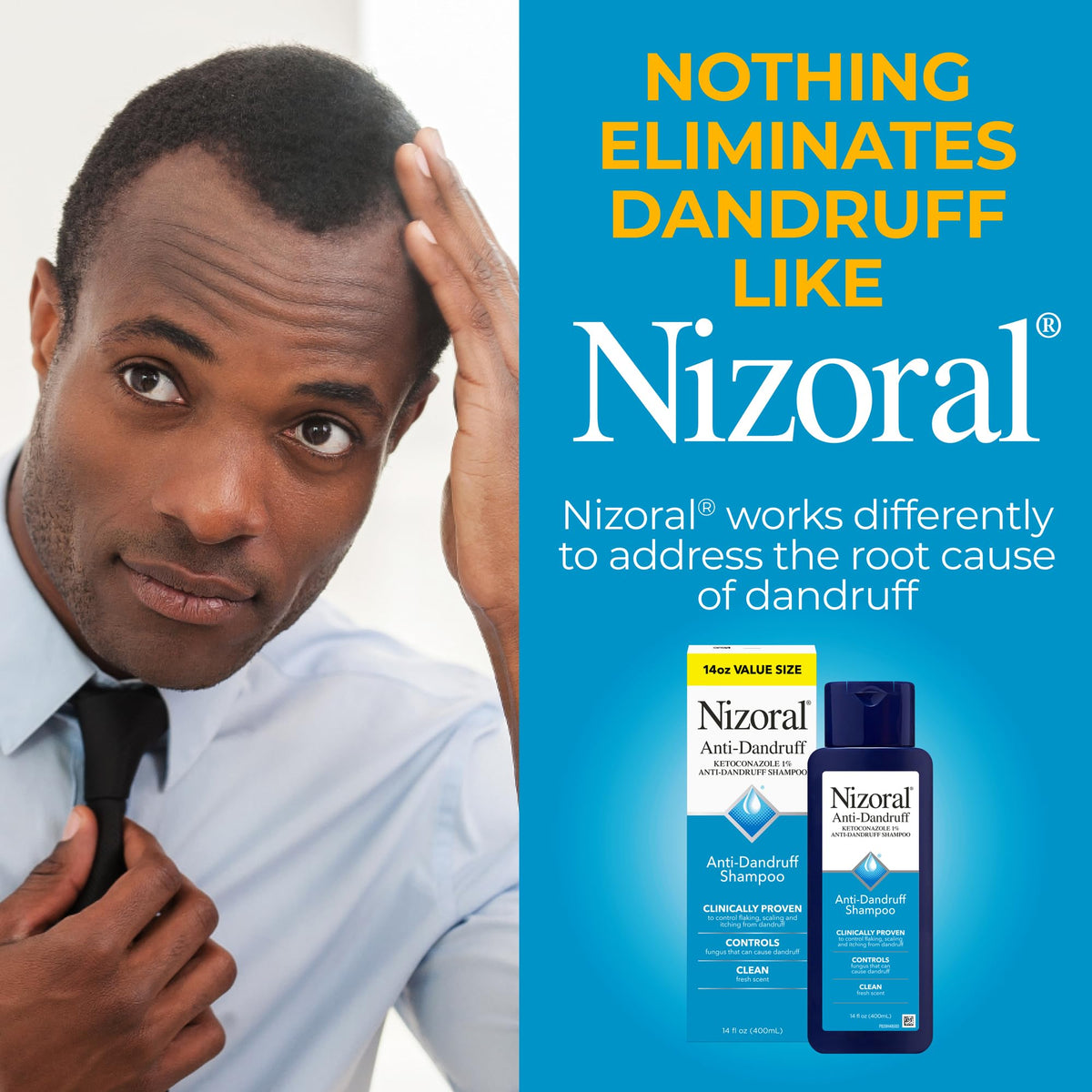 Nizoral size comparison with hand to show 14 fl oz volume benefit
