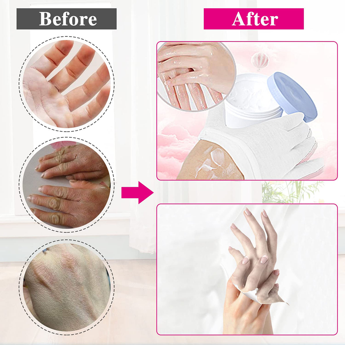 NJDGF gloves worn during nighttime cream application to lock in moisture