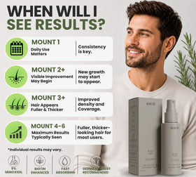 NOCTE used on beard area showing increased density and fuller beard benefit