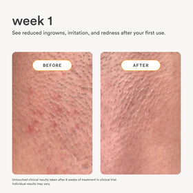 Nood close-up colloidal oatmeal ingredient soothing irritated skin