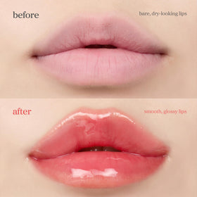 NOONI before and after lips showing enhanced fullness and glossy finish