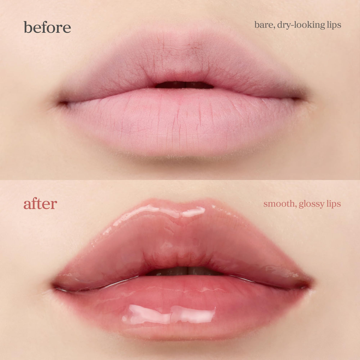 NOONI lip before and after showing visible smoothing and subtle plump