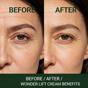 NOOR CREAM used on neck and jawline showing targeted lift and smoother contour