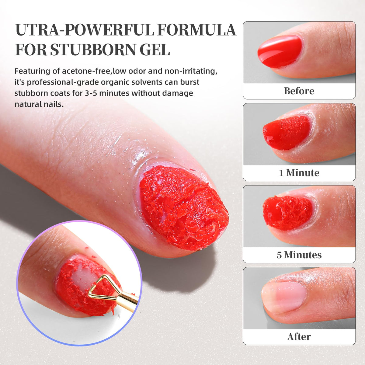 NORCICO gel applied to a nail showing fast softening benefit