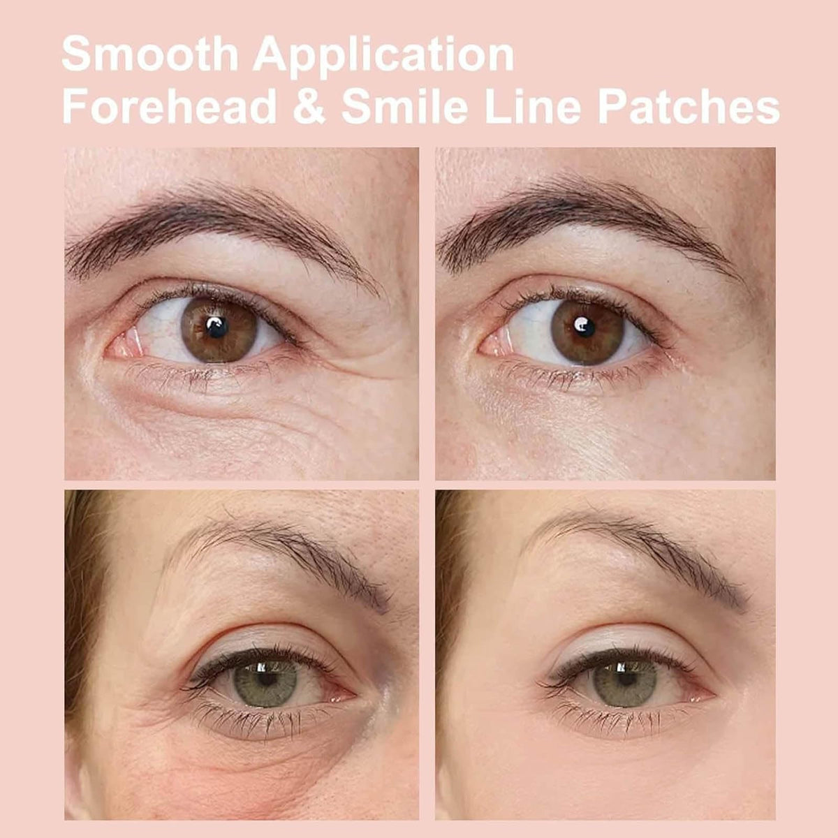 NOVALIFT smile line patch in use smoothing fine lines for a refreshed look