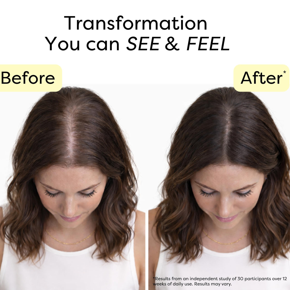 NOVOKIND applying serum to scalp illustrating easy massage and follicle care benefit