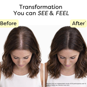 NOVOKIND applying serum to scalp illustrating easy massage and follicle care benefit