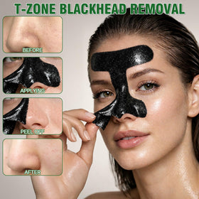 Nozerix extractor tool beside jar for precise pore care benefit