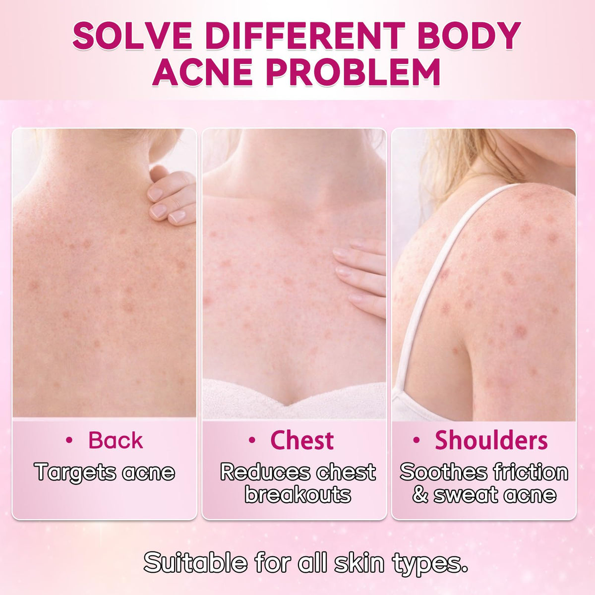 Nozerix ingredient label detail, highlights salicylic acid and botanicals