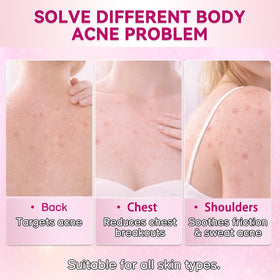 Nozerix ingredient label detail, highlights salicylic acid and botanicals