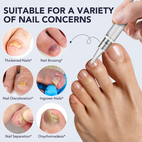 NQINQI pen being applied to toenail showing targeted, mess-free use