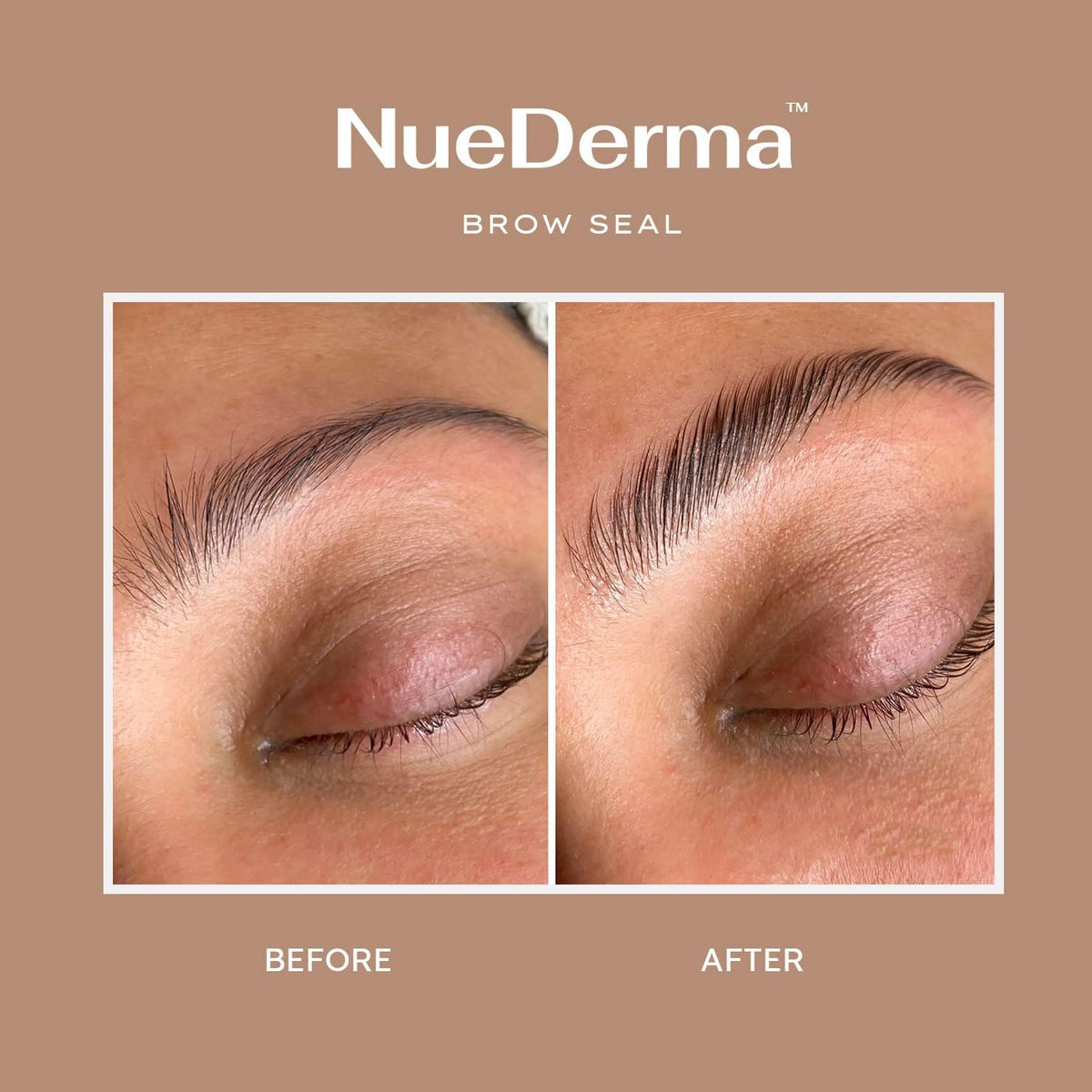 NueDerma castor oil drop near gel highlighting natural conditioning benefit