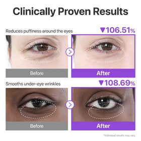 numbuzin patch applied under eye demonstrating secure fit and cooling comfort