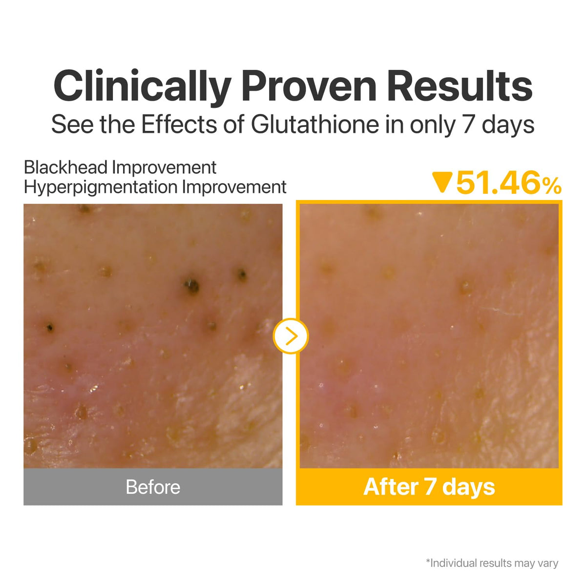 numbuzin No.5 dissolving waterproof mascara on skin, demonstrates effective makeup removal