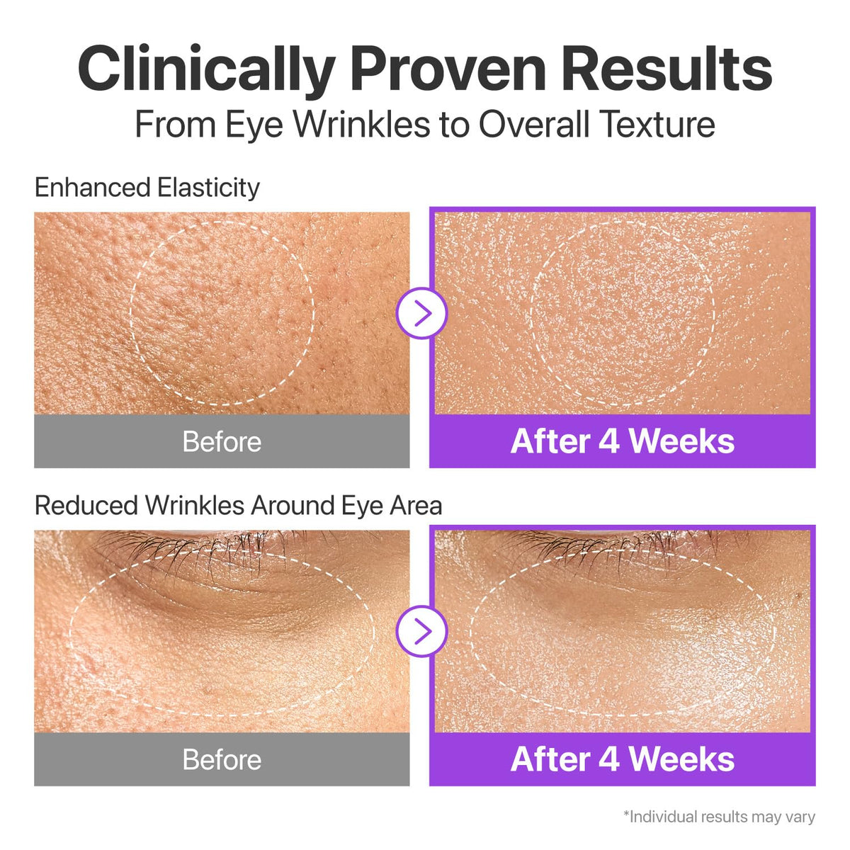 numbuzin applying serum to face during morning skincare routine