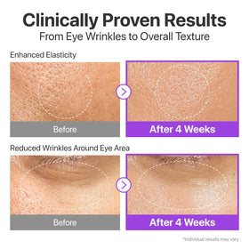 numbuzin applying serum to face during morning skincare routine
