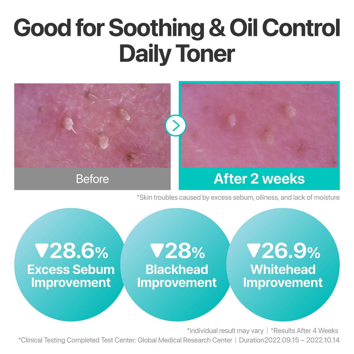 numbuzin close-up of centella and heartleaf ingredients soothing benefit