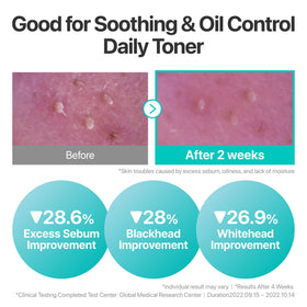 numbuzin close-up of centella and heartleaf ingredients soothing benefit