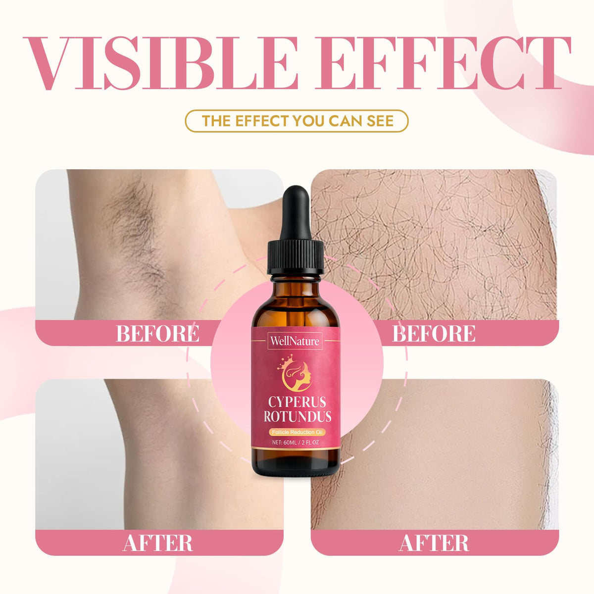 nutramd leg scale comparison suggesting gradual reduction in visible hair and smoother skin over time