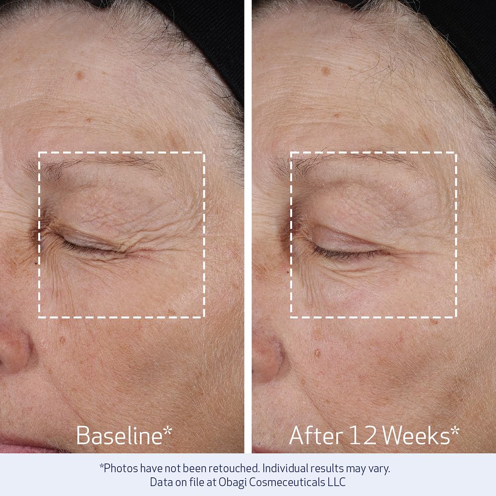 Obagi ELASTIderm applied along jawline illustrating lifting and sculpting application