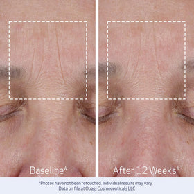 Obagi ELASTIderm ingredients label featuring Bi-Mineral Contour Complex for contouring